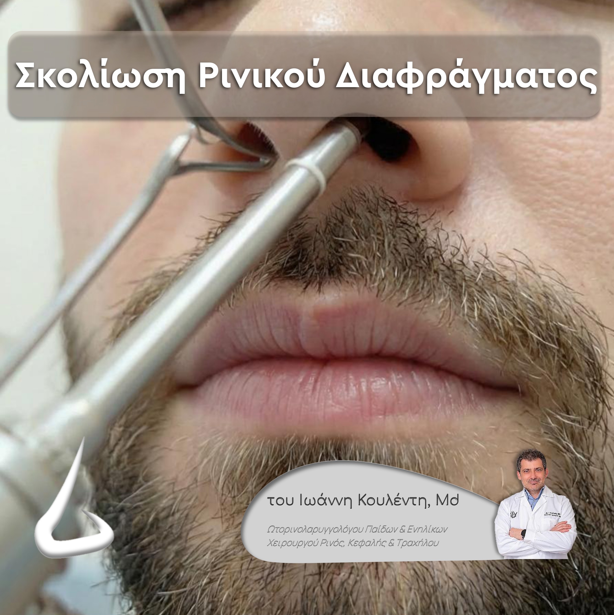 Σκολίωση Ρινικού Διαφράγματος